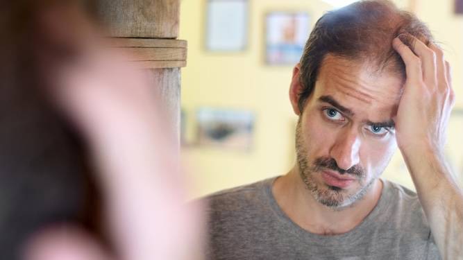 The six stages of a man getting a hair transplant