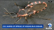 CDC warns of spread of Chagas disease from 'kissing bugs,' says it could become endemic illness in US