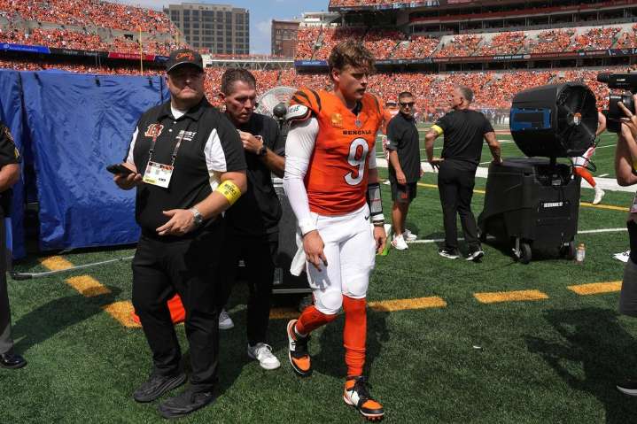 What is turf toe and why will it sideline the Bengals’ Joe Burrow for a few months?