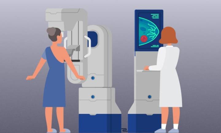 Molecular breast imaging may benefit women with dense breasts, suggests research