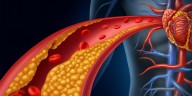 La raíz asiática que reduce el colesterol antes de llegar a tu corazón