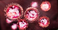 Measles outbreak: Brisbane hit by new case as Queensland gets hit by more cases