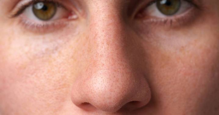 Lesser-known sign of Parkinson's disease that can show up in your nose