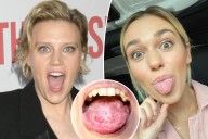 What is 'geographic tongue'? All about 'SNL' star Kate McKinnon's 'gross' condition