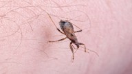 EEUU confirma que la enfermedad de Chagas es ya endémica