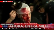 Gravísimo: agredieron a un periodista en el acto de Javier Milei en Moreno