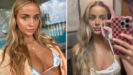 Gabby Goessling: Aussie influencer addresses fan shock after boyfriend popped pimple with a serrated knife