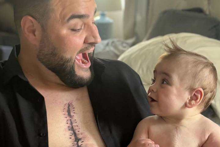 Dad Gets Baby Son's Heart Surgery Scars Tattooed on His Chest (Exclusive)