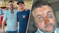 After gnarly wipeout in Encinitas, visiting ‘surfer’ looking for mystery rescuer