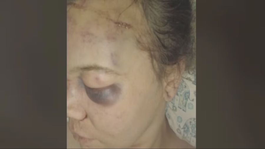 Group of teens made homophobic remarks during Renton assault