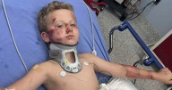 8-year-old boy on bicycle recovering after hit-and-run in Fort Worth: "He was covered in blood," mom says.