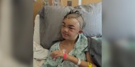Parents say middle schooler was attacked by another student in cafeteria, had to have parts of skull removed