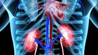 Mortality Rates From Hypertensive Renal Disease Increased From 1999 to 2023