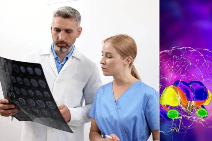 New Huntington's disease treatment has 75% success rate