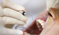 High Blood Sugar Levels Increase the Risk of Periodontal Disease: Study
