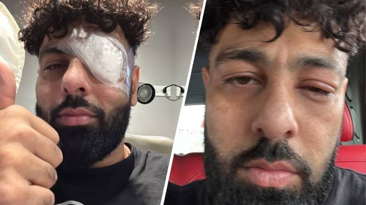 Injured Badshah's Shout Out Post To Bads Of Bollywood Worries Fans Entertainment News