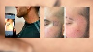 Borrar tatuajes con láser: cuánto cuesta y cuánto tiempo lleva realmente