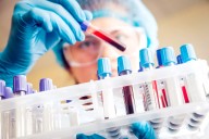 Dr. Lino Ojeda: Prueba de laboratorio una rutina que se debe hacer para prevenir enfermedades