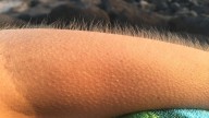 Las personas a las que se les pone la piel de gallina al escuchar música son más sofisticadas emocionalmente