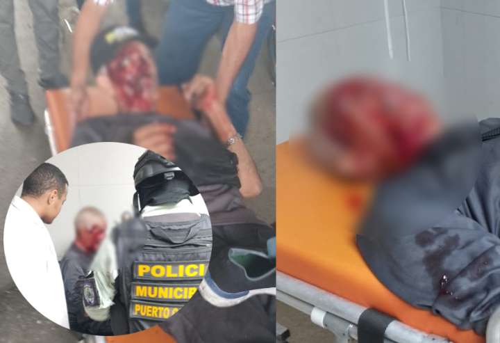 Accidente en bicicleta deja a adulto mayor herido en importante vía porteña