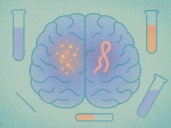 Entre proteínas y memorias… Los avances que reescriben la detección del Alzheimer