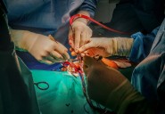 El Virgen del Rocío alcanza las 100 cirugías cardíacas mínimamente invasivas en pacientes pediátricos