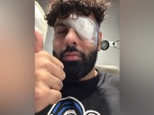 Singer Badshah injures his left eye during music tour