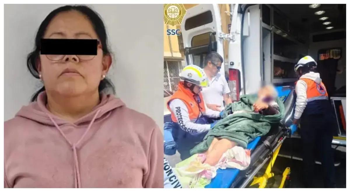 Adulta mayor pierde parte del brazo tras ataque de pitbull en Iztapalapa, CDMX