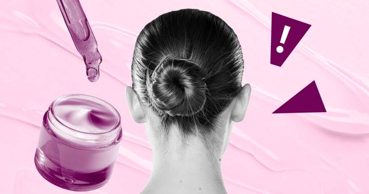 My Dermatologist Pile on the Acne Shame: Personal Essay