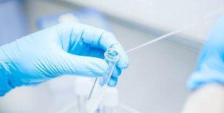 Resistencia microbiana matará a 10 millones en 2050: UNAM