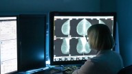 Healthwatch 16: Breast density and mammograms