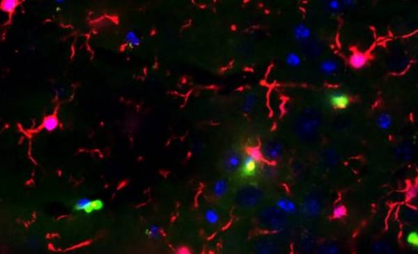 Un medicamento para la diabetes podría proteger contra el Alzheimer