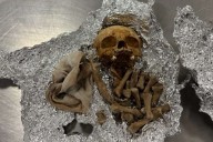 Human Skull and Bones Found in Passenger's Luggage at Florida Airport