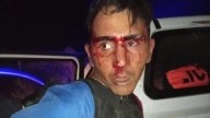 Justicia por mano propia: vecinos de La Rinconada desfiguran a golpes a un presunto ladrón