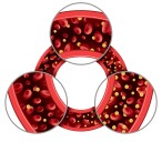 Cadisegliatin, an Oral Drug For Type 1 Diabetes, Begins Phase 3 Trial