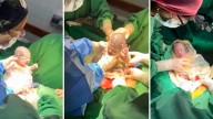 Nacieron trigemelas en Salta, un caso que sucede cada un millón
