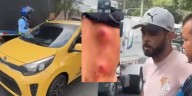 Taxista le disparó dos veces a un conductor de grúa que lo estaba ayudando a desvarar: qué fue lo que pasó