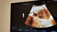 Lanzan iniciativa multimillonaria para la prevención de la muerte fetal intrauterina