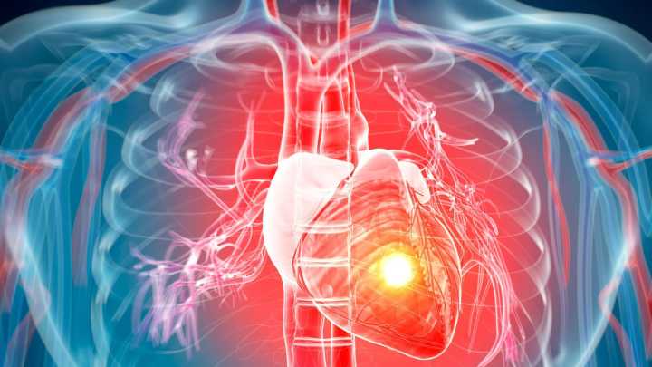 You can 'CATCH a deadly heart attack' as scientists discover they 'can be contagious'