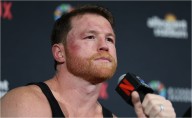 Canelo Álvarez se someterá a cirugía; ¿cuánto tiempo estará fuera el mexicano?