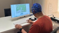Oportunidades terapéuticas de la estimulación cerebral no invasiva