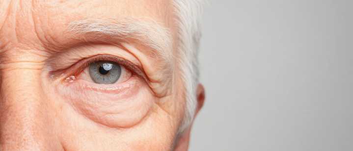 Skin Cancer Burden in Older Adults Expected to Rise Through 2050, Study Shows
