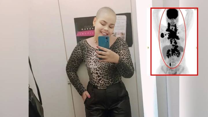 Influencer revela los síntomas que ignoró, pero resultaron ser un raro y agresivo cáncer que “la aplastaba por dentro"
