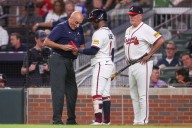 Braves' Ozzie Albies breaks bone in left hand