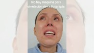ISSSTE restablece procedimiento de simulación para iniciar radioterapia a derechohabiente