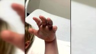 4-year-old bitten by copperhead at North Carolina day care; aunt questions why staff didn’t call 911
