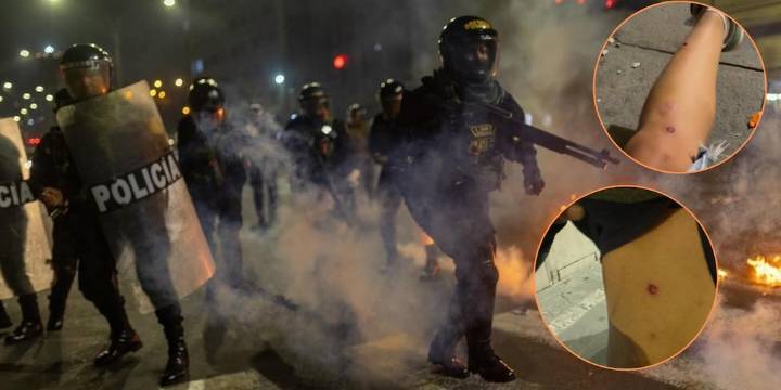 Periodistas heridos por perdigones de la PNP durante la marcha de la Generación Z en Lima