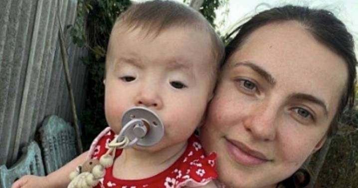 Parents thought their baby just hadn't opened her eyes yet