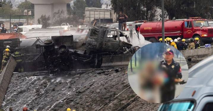 "Los milagros existen": Así se encuentra Alicia, la abuelita que protegió a su nieta de 2 años en la explosión de pipa en Iztapalapa