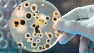 'Nightmare Bacteria' Cases Increase By Nearly 70%, CDC Report Reveals: What Is It And How To Recognize It's First Signs